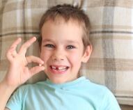 La caduta del primo dentino