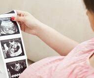 Ecografia morfologica, cos'è e quando si fa