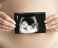 Ecografie in gravidanza, quali fare e quando