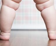 ginocchio valgo nei bambini in aumento le gambe a x