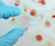 Gruppi sanguigni e fattore Rh