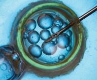 Fecondazione Assistita Legge