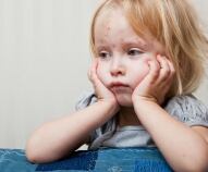 malattie esantematiche nei bambini