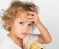 Morbillo nei bambini