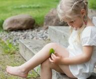 Traumi e contusioni nei bambini