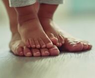 Piedi piatti nel bambino