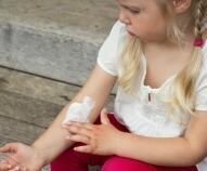 Psoriasi nei bambini