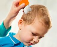 rimedi contro i pidocchi