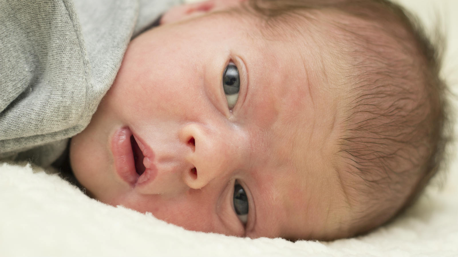 come eliminare la crosta lattea